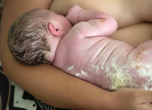 Vernix