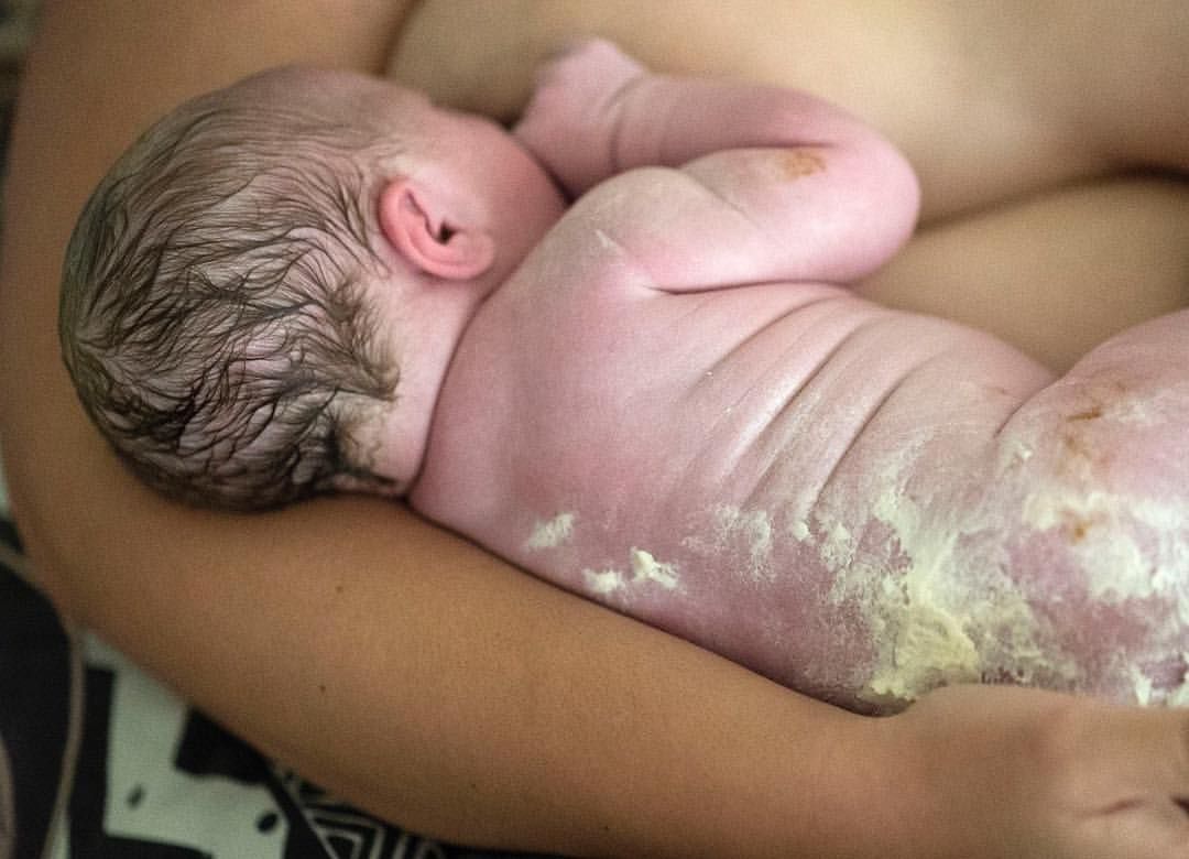 Vernix Caseosa Wikipedia, 43% OFF | www.elunicornio.co